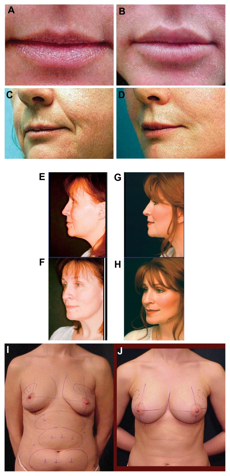 Figure 18