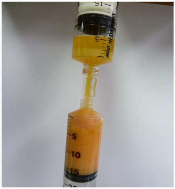 Figure 15