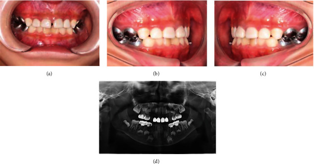 Figure 5