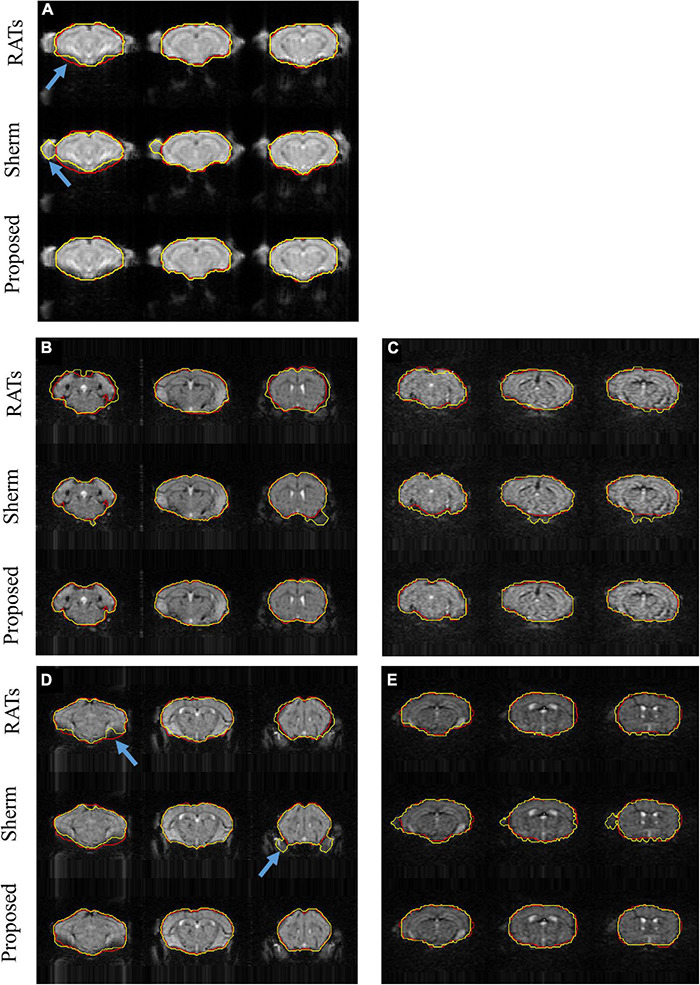 FIGURE 3