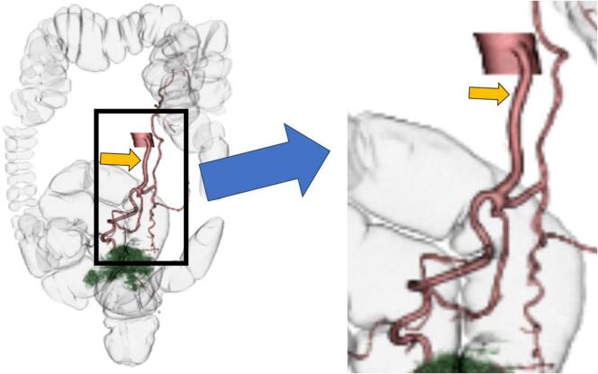 Fig. 2