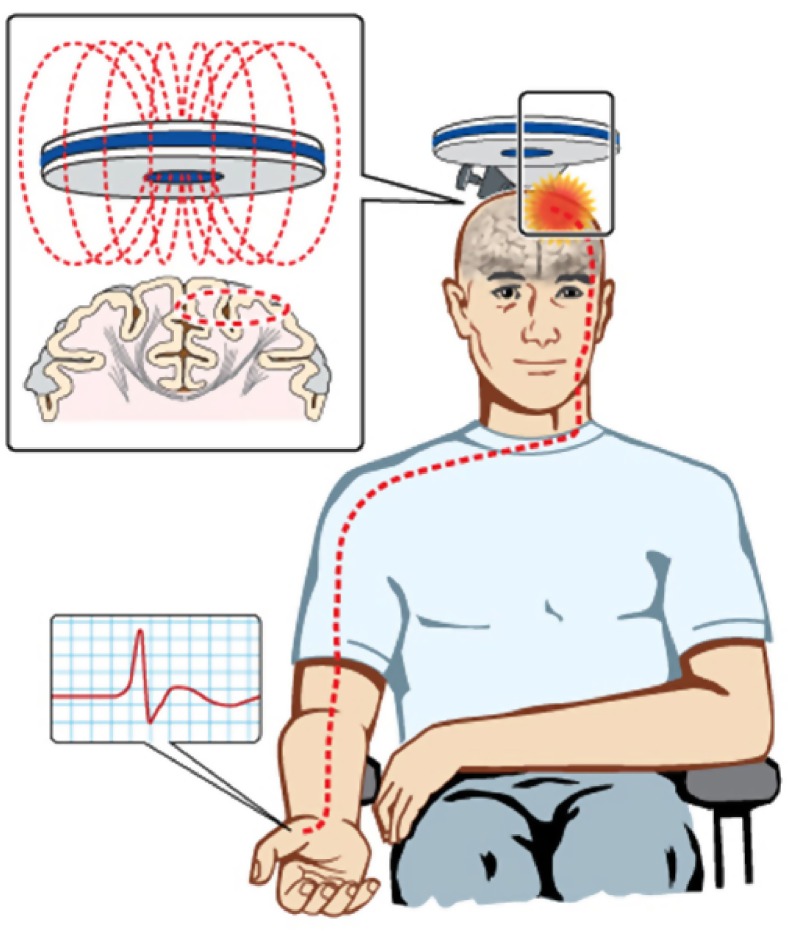 Figure 1