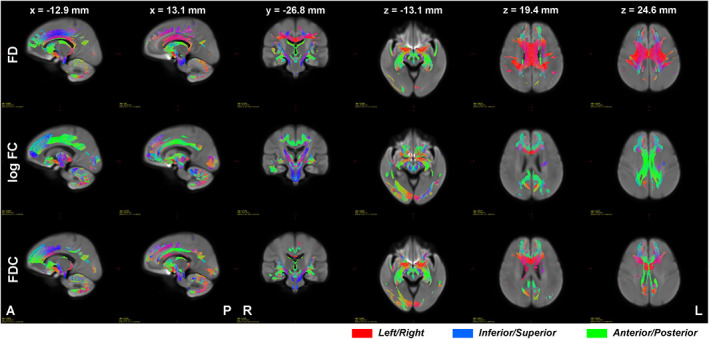 FIGURE 3