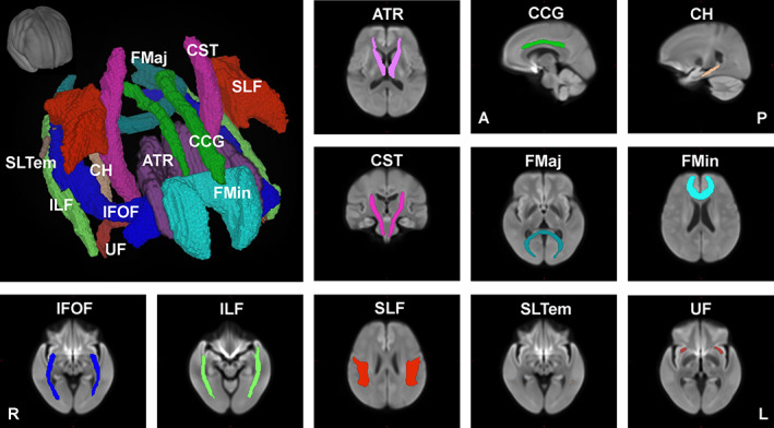 FIGURE 2