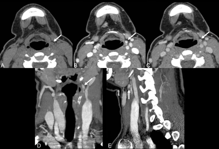 Fig 2.