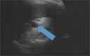 Fig. 13 A