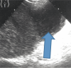 Fig. 12 B