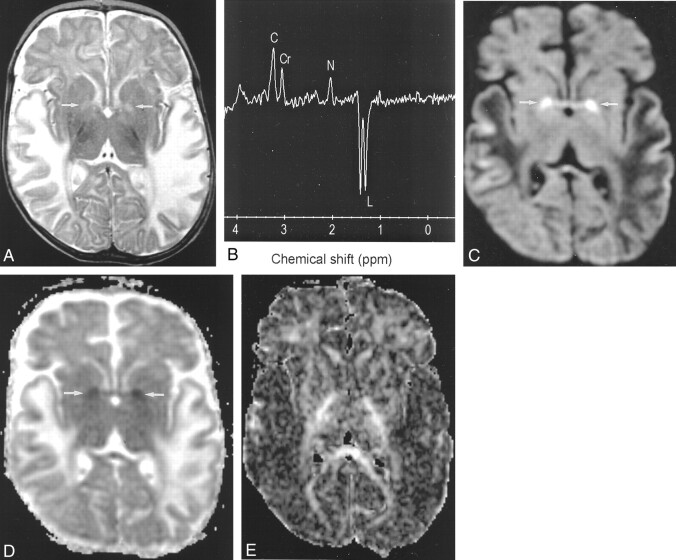 Fig 1.