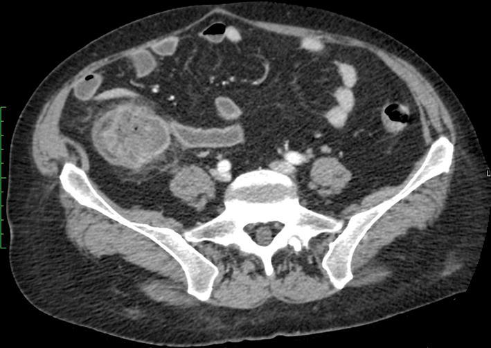 Fig. 4