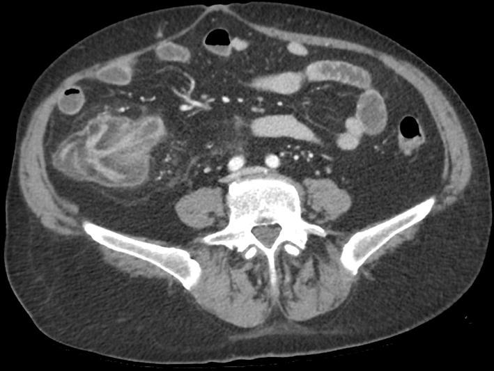 Fig. 3