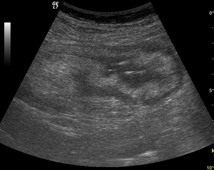 Fig. 1