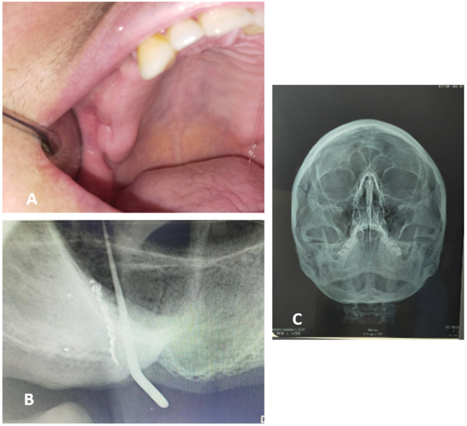 Fig. 1