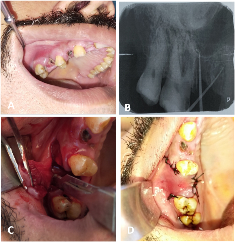 Fig. 10