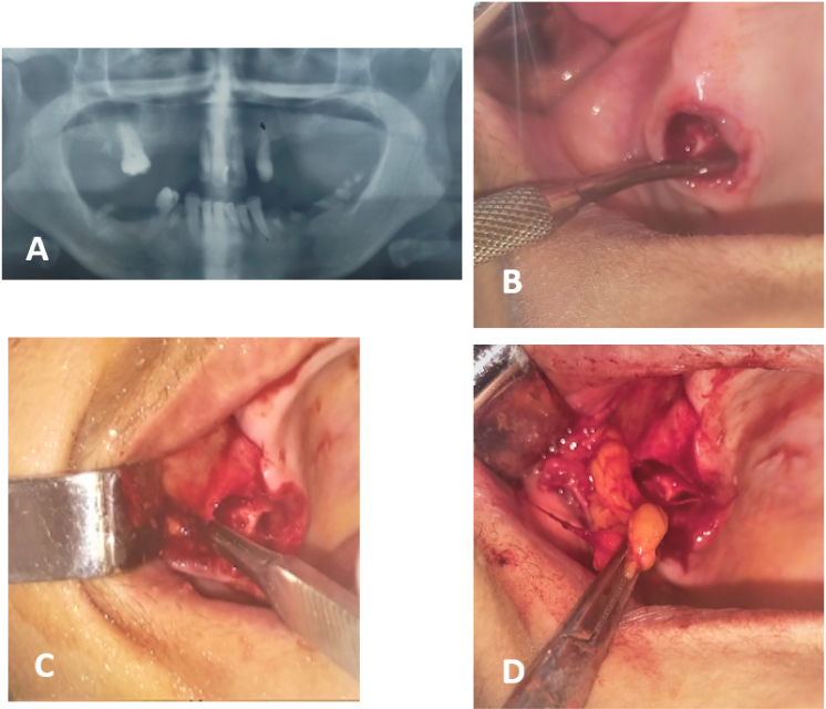 Fig. 6