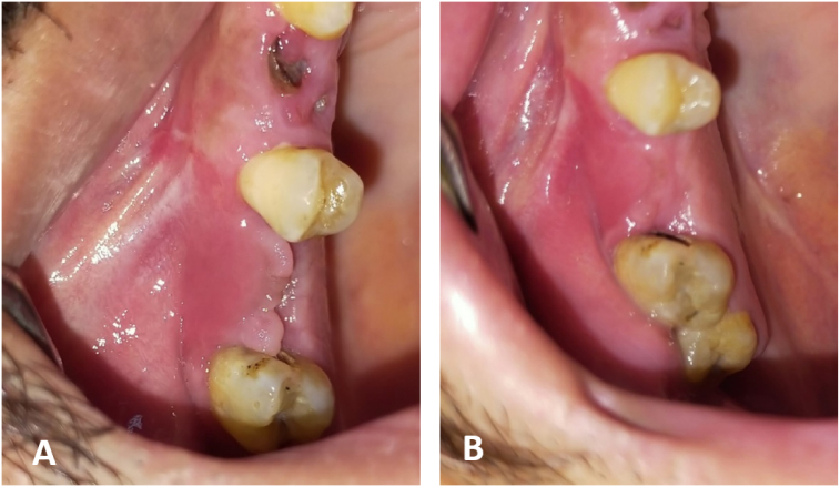 Fig. 11