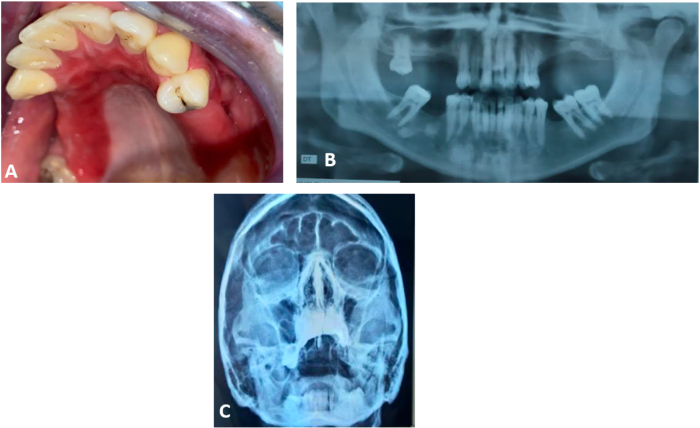 Fig. 4