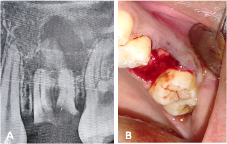 Fig. 8