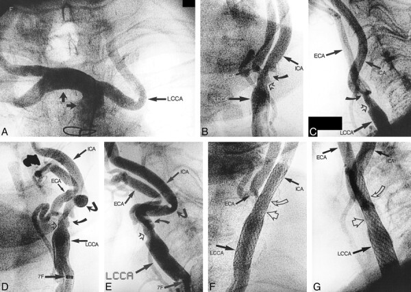 fig 2.