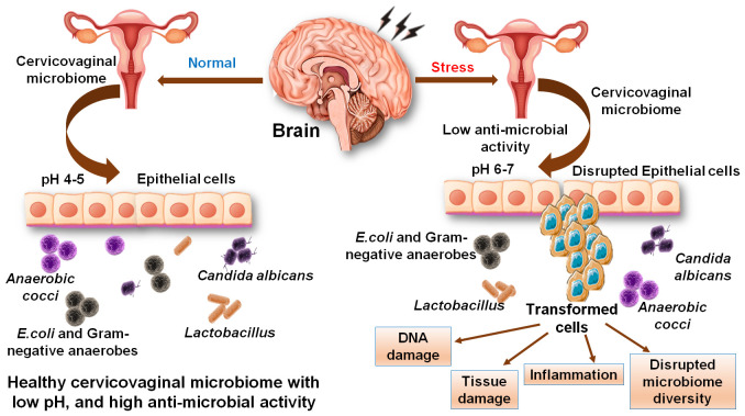 A Systematic Assessment Of Stress Insomnia As The High-risk Factor For 