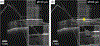 Fig. 15.