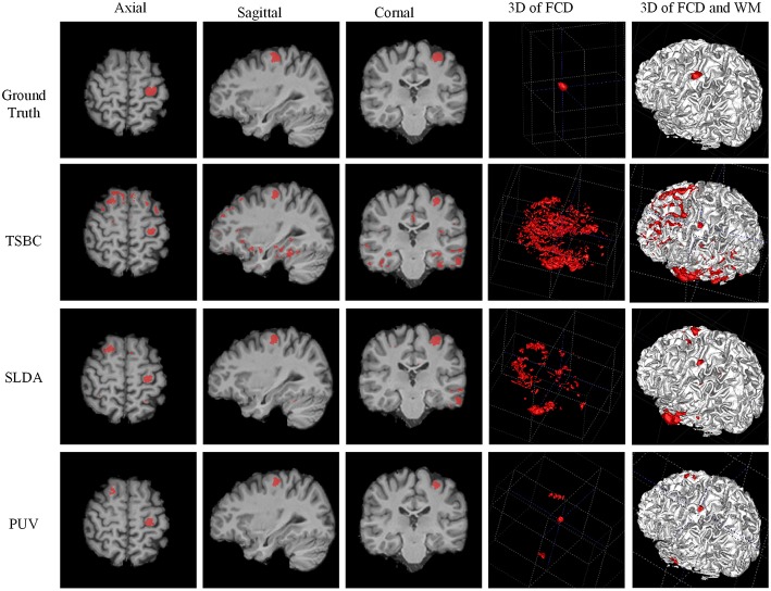 Figure 11