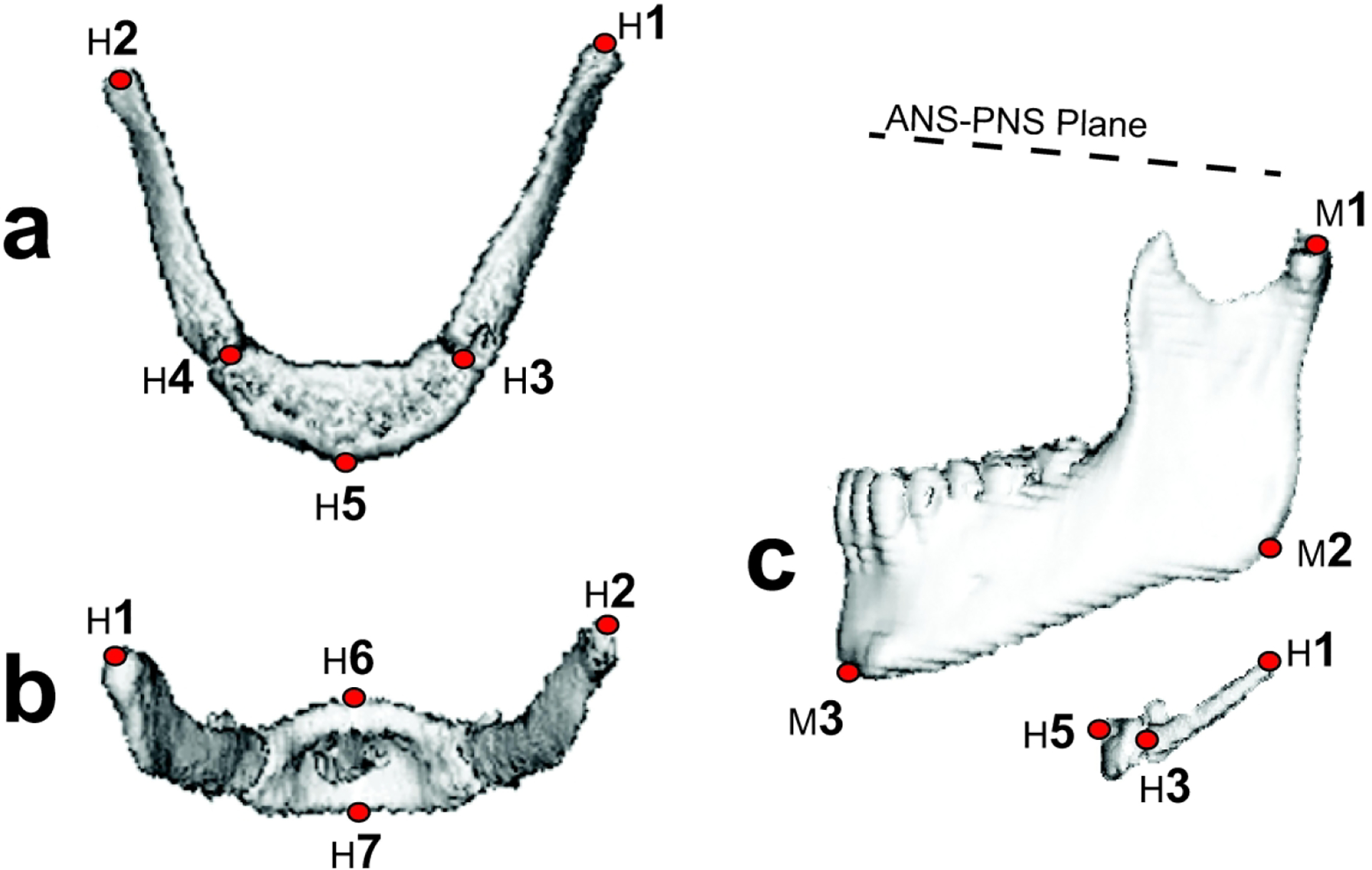 Growth and sexual dimorphism of the hyoid bone and its relationship to ...