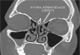 Fig1
