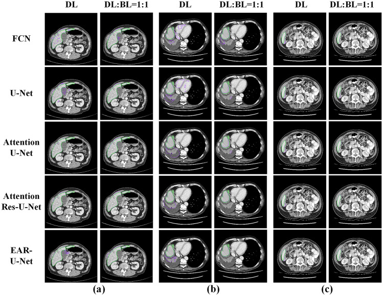 Fig. 14