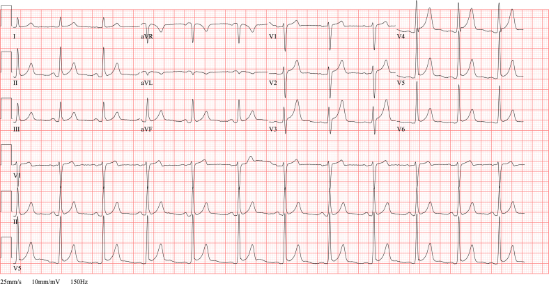 Fig. 9