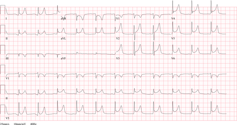 Fig. 4