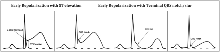 Fig. 10