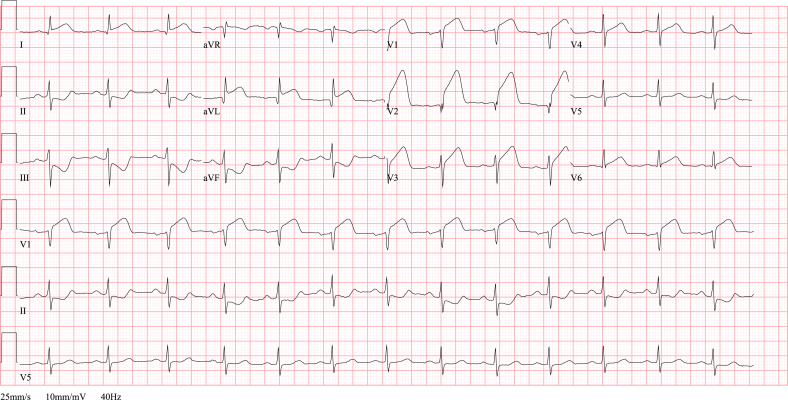 Fig. 3