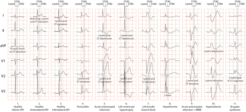 Fig. 11