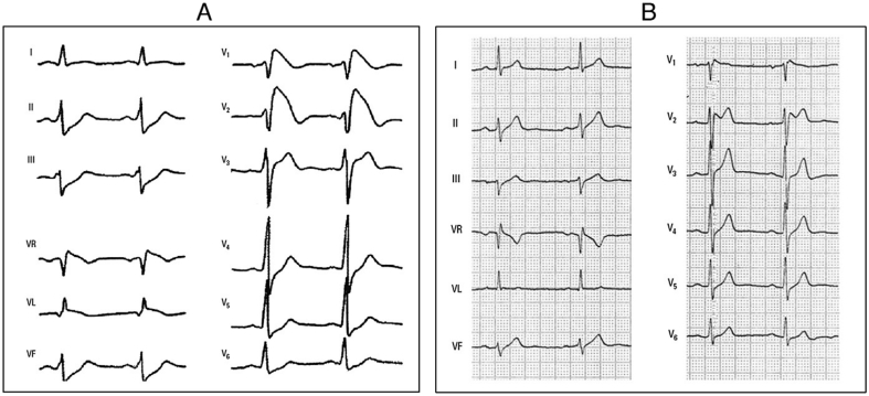 Fig. 7