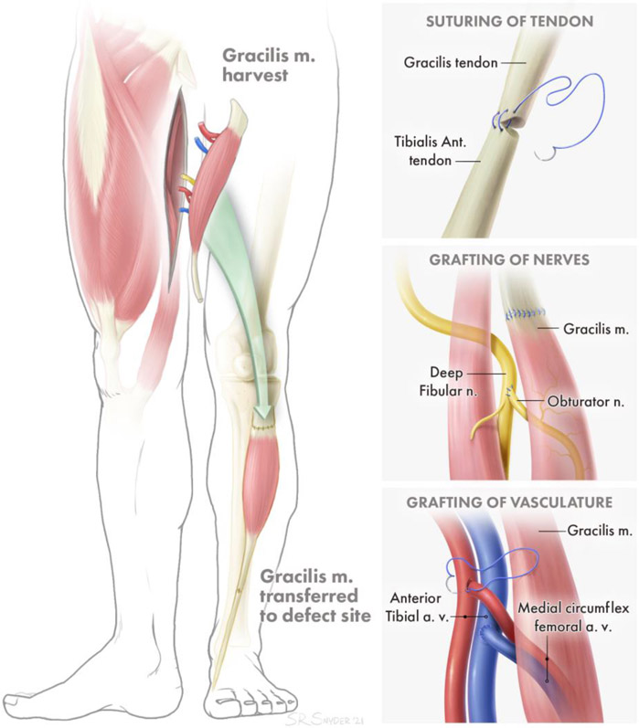 Figure 1: