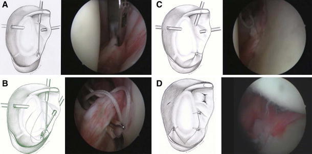 Fig. 1