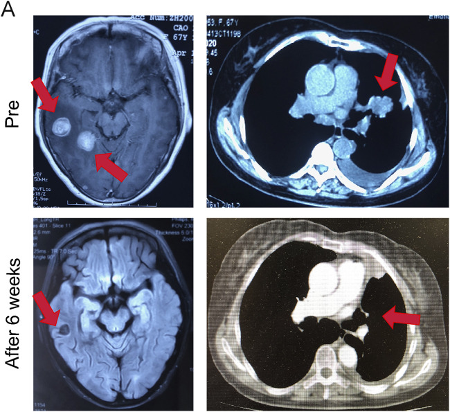 FIGURE 6