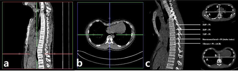 Fig 3