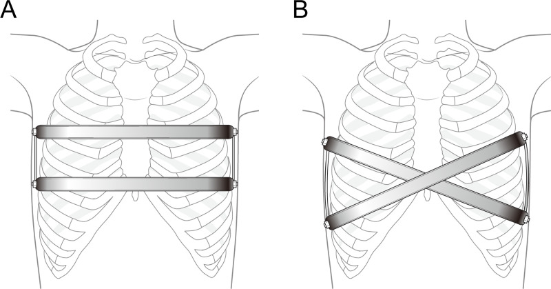 Fig 2