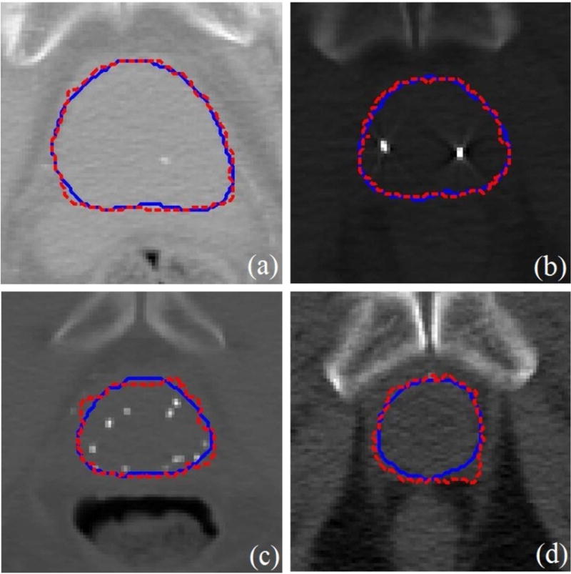 Fig. 11