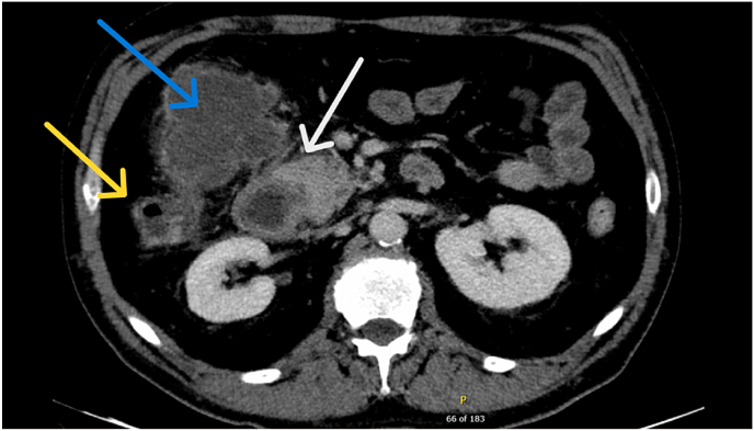 Fig. 1