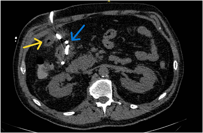 Fig. 2