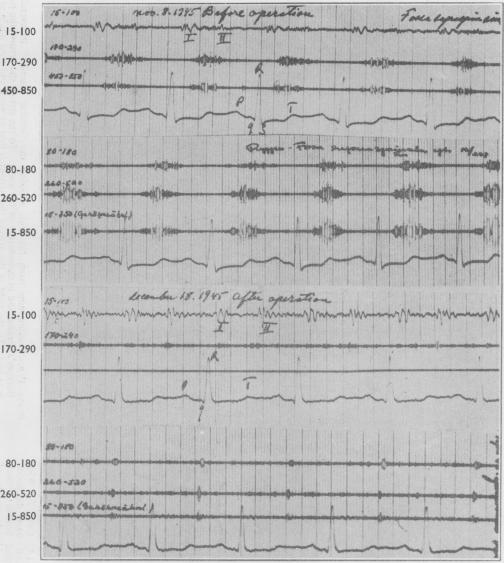 graphic file with name thorax00007-0022-a.jpg