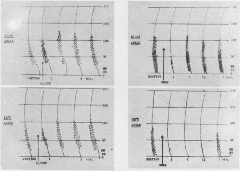 graphic file with name thorax00007-0024-a.jpg