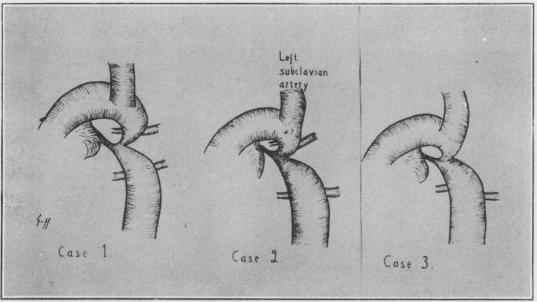 graphic file with name thorax00007-0020-a.jpg