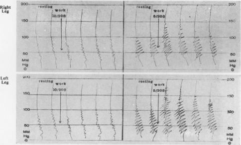 graphic file with name thorax00007-0024-b.jpg