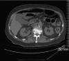 Fig. 2