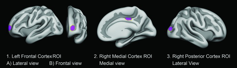 Fig 1.