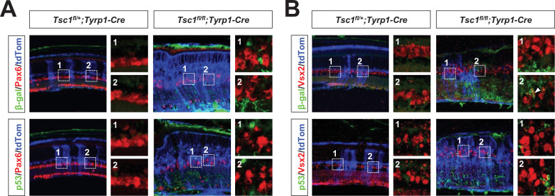 Figure 5—figure supplement 4.