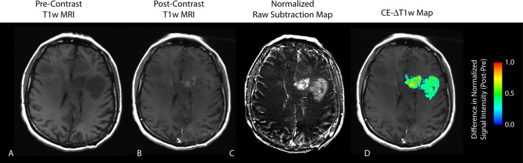 Figure 1: